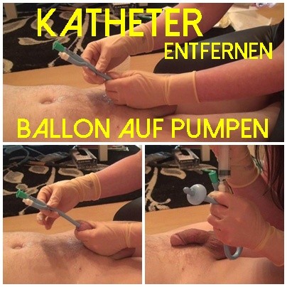 Katheter entfernen Ballon auf pumpen